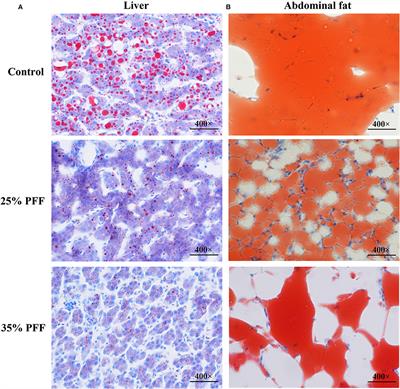 Probiotic Fermented Feed Alleviates Liver Fat Deposition in Shaoxing Ducks via Modulating Gut Microbiota